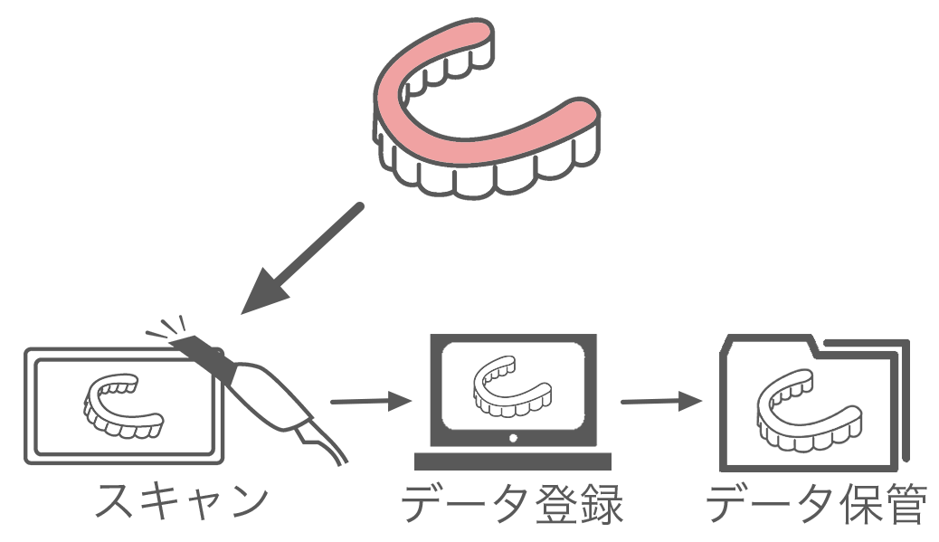 入れ歯の立体データ保管サービス